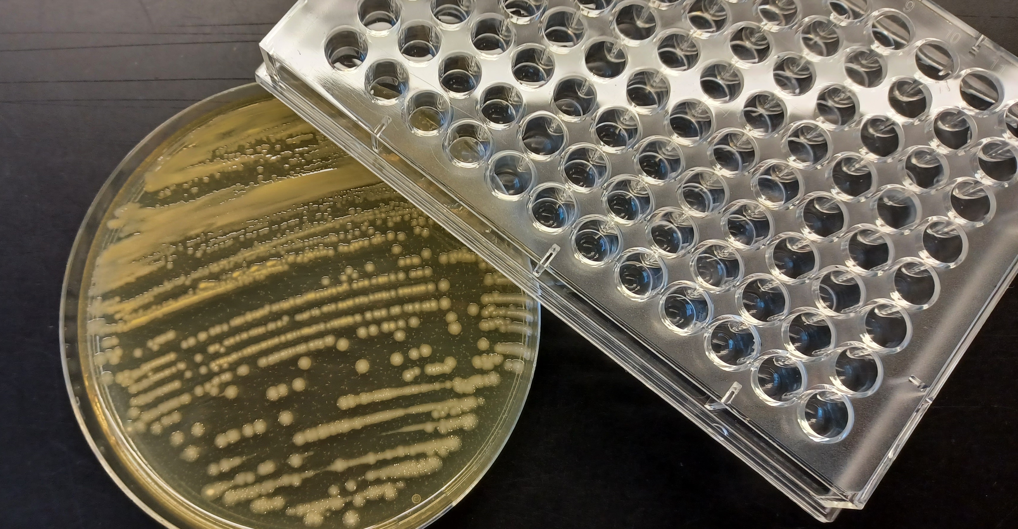 Un equipo multidisplicinar del CIBIR, el Hospital San Pedro y la Universidad de La Rioja busca recrear el biofilm de las bacterias en laboratorio